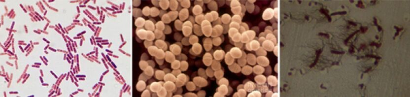 E. coli, enterokoki kałowe i proteus są głównymi przyczynami przewlekłego bakteryjnego zapalenia gruczołu krokowego