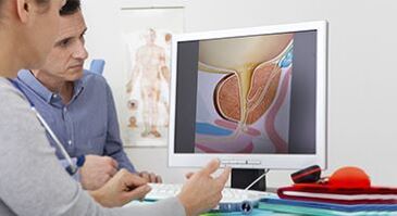diagnozowanie zapalenia gruczołu krokowego u mężczyzny